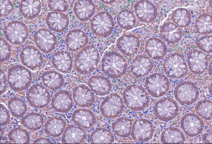 Cell detection with LazySlide