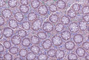 Cell detection with LazySlide