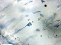 Gel-filled Pore