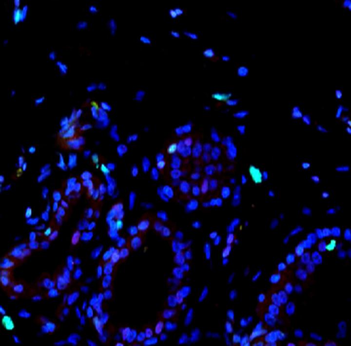 Healthy Breast Tissue