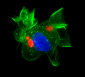 Toxoplasma 2