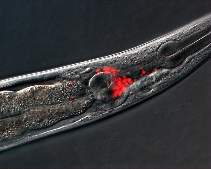C. elegans roundworms engineered with fluorescent proteins to visualize neurons.