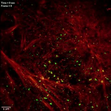 Individual CCPs and Clathrin Plaques