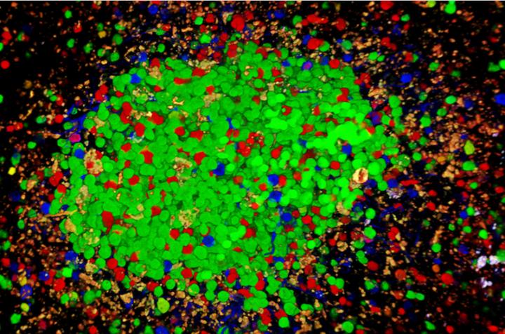 B Cells Battle Each Other