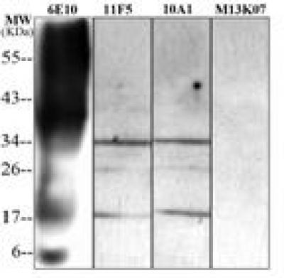 Anti-beta-amyloid 