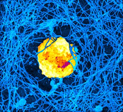 Lytic Granule Surrounded by Actin Filaments