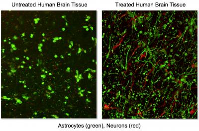 Discovery Leads to Patent for Novel Method of Treating Traumatic Brain Injury