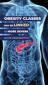 Obesity classes may be linked to more severe acute pancreatitis