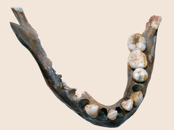 Mandible of Matjes River 1 woman