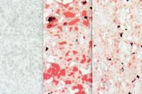 Natural Sugar Defends Against Metabolic Syndrome, in Mice