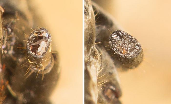 Wound Before and After Treatment