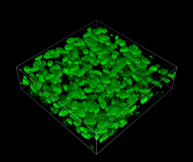New In Vitro (In-laboratory) 3D Model Representing the Arterial Walls in the Lungs