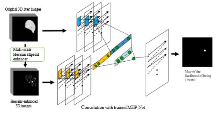 Overview of MHP-Net