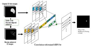 Overview of MHP-Net