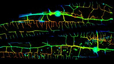 Pruning Neuronal Trees (5 of 6)