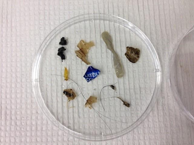 Microplastics in Rivers