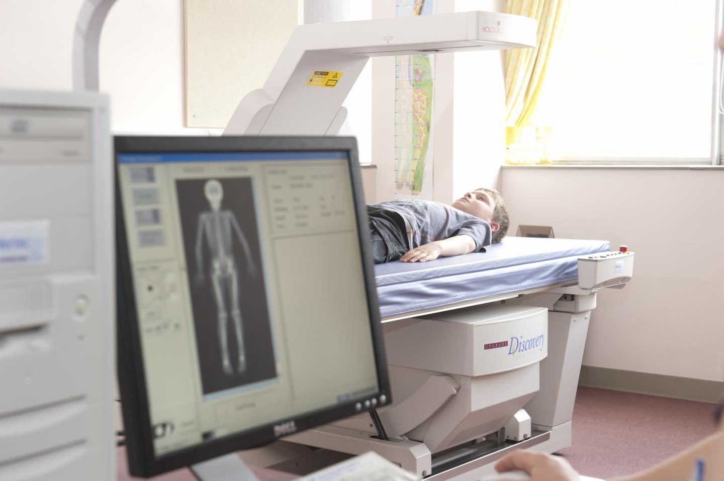 DXA Bone Scan