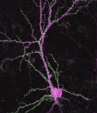 A Genetic Pathway to Speech and Language?