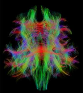 Diffusion MRI