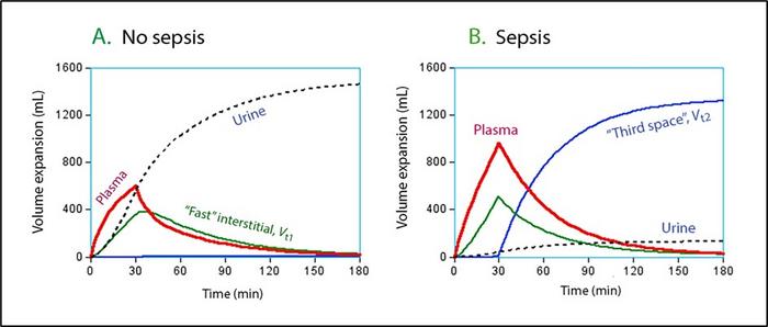 Simulation of fluid distribution in healthy and septic sheep