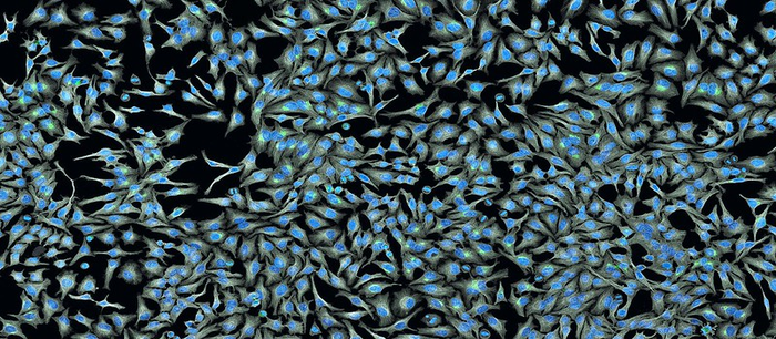 Hela cells