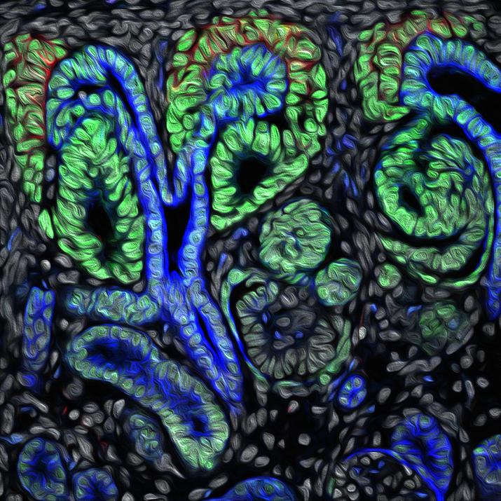 Kidney Stem Cells