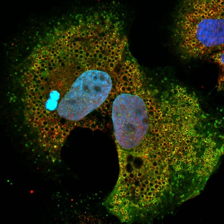 Connecting the Droplets: a Rare Disease Gene Has a Key Role in Chronic Hepatitis C Infection