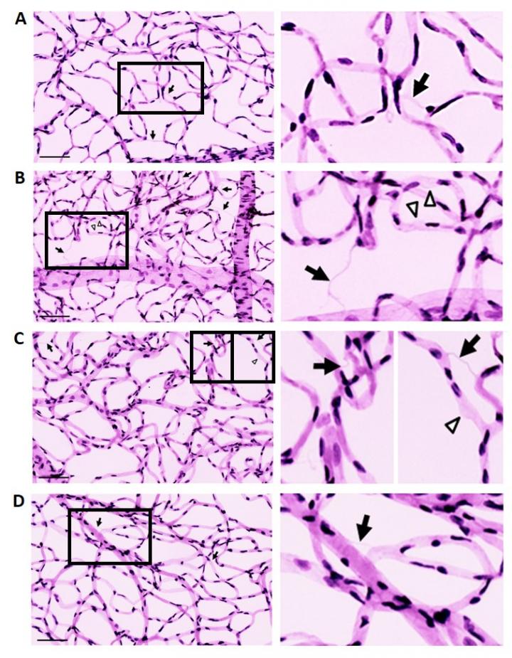 Scientists Identify a Possible New Treatment for Daiabetic Retinopathy