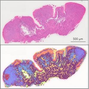 Spatial transcriptomic analysis of the epipharynx using Visium HD