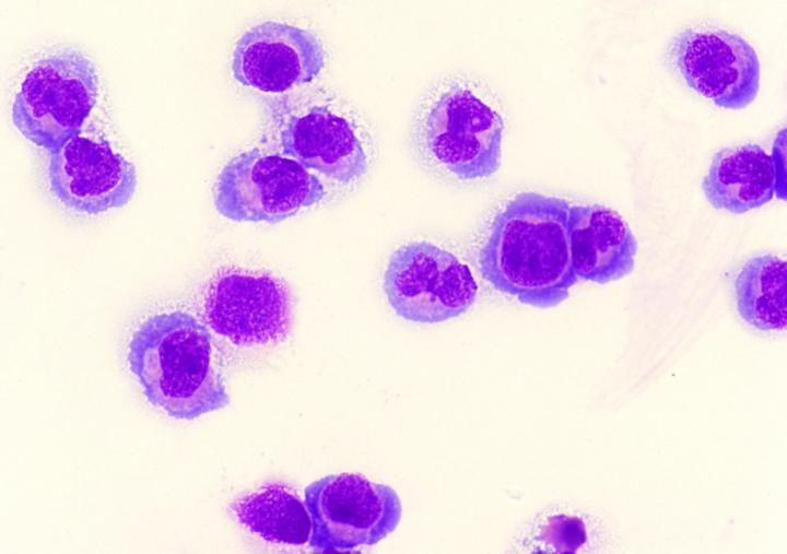 AML Cell Lines Expressing MLL-Fusion Genes