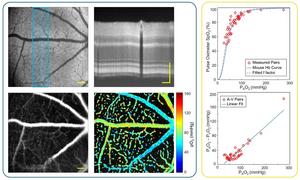 The new multimodal system combines visible light optical coherence tomography (VIS-OCT) with phosphorescence lifetime ophthalmoscopy (PLIM-SLO) to capture detailed structural images alongside quantitative oxygen partial pressure (pO₂) measurements.