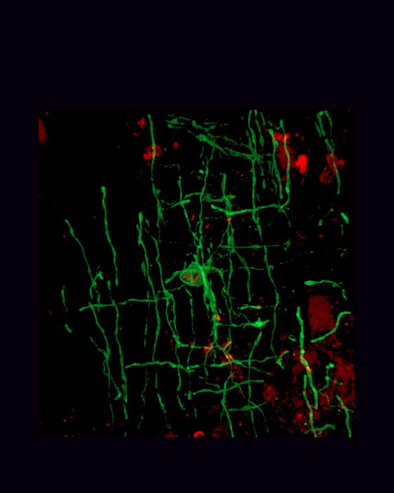A myelinating oligodendrocyte (green)