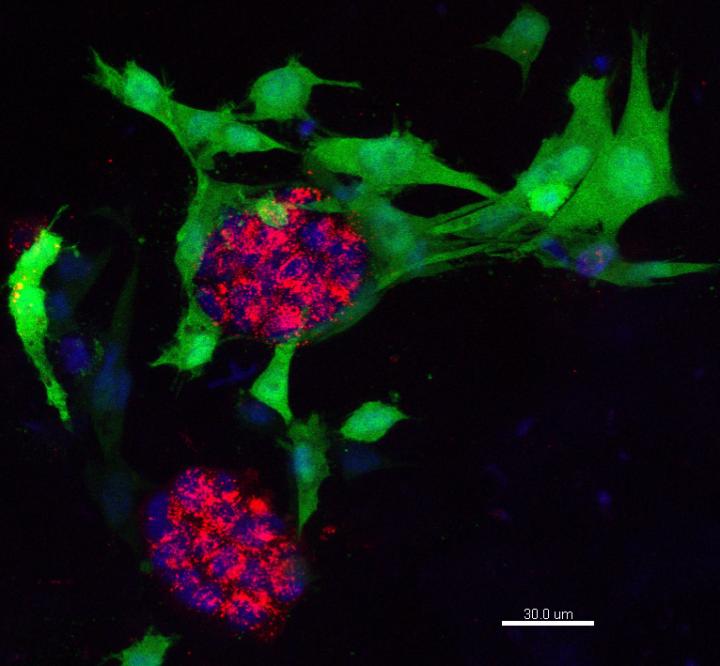 Breast Cells 