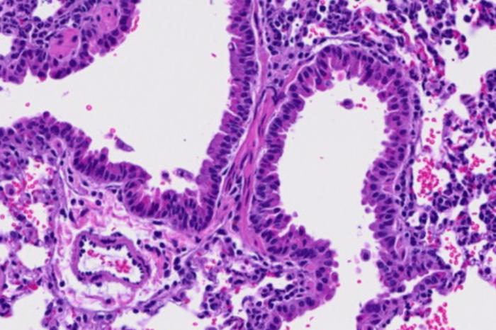 SARS-CoV-2–infected mouse lung