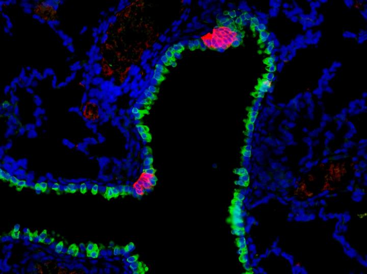 Lung Cells