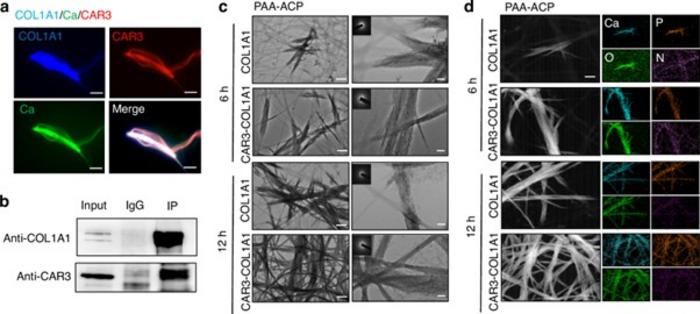 CAR3 protein found to promote collagen mineralization and strengthen bone formation