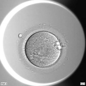 Human embryo development