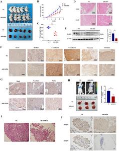 RAB26 promotes prostate cancer proliferation and metastasis in vivo.