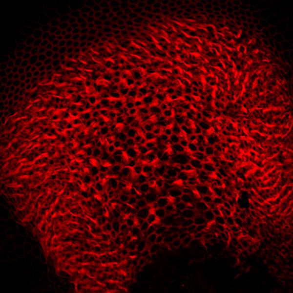 Gene Therapy for Deafness