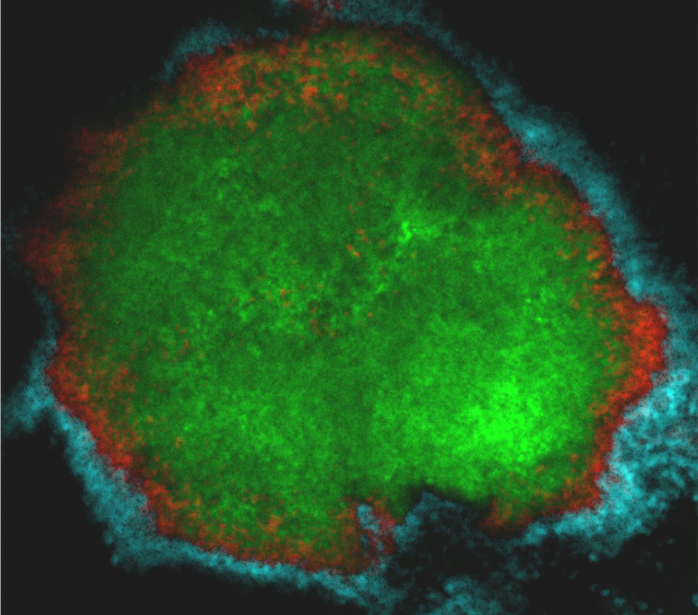 Tooth Decay Bacteria Shields Itself with Other Microbes