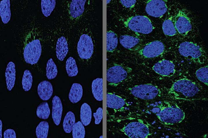 Zika in Placental Cells