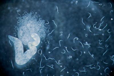 Parasitic Nematode