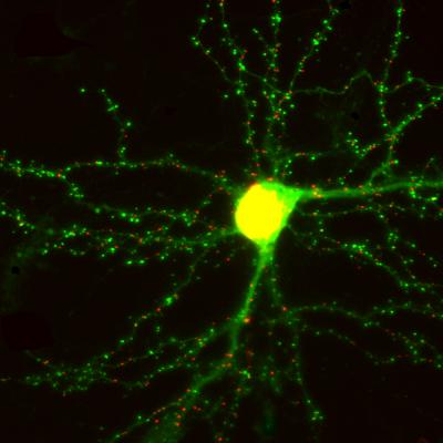 Neuron