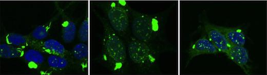 Tau Cell