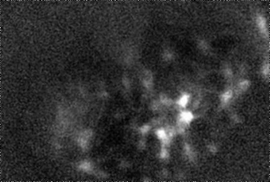 In Vivo Hippocampus