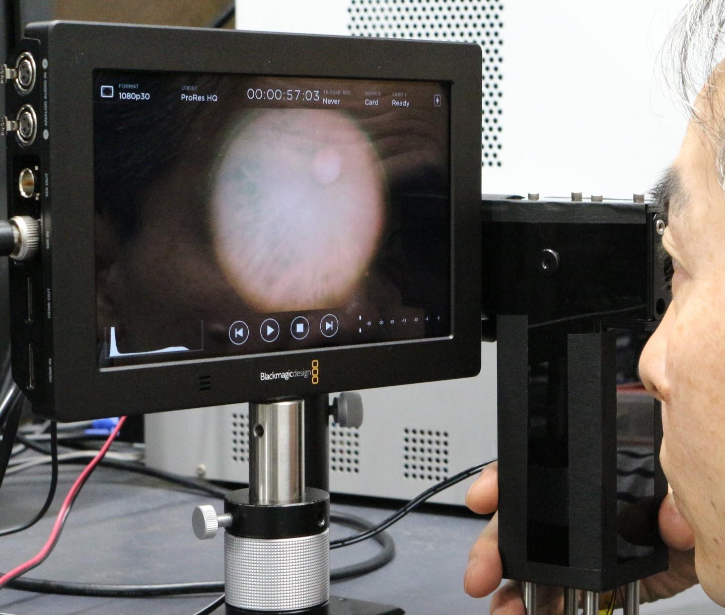 Fundus