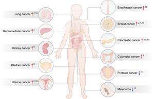 Type 2 diabetes and the risks of cancer.