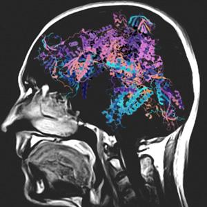 Computer Image of a Head in Nuclear Magnetic Resonance