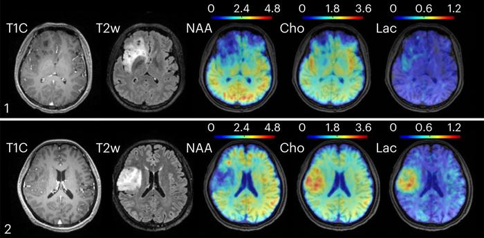 Metabolic MRI
