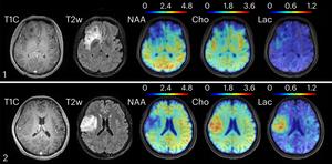 Metabolic MRI